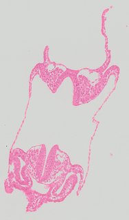 ds_10283_1098