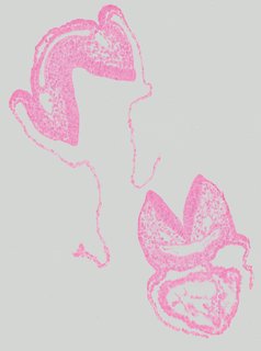 ds_10283_1112
