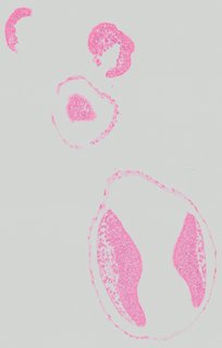 ds_10283_1123