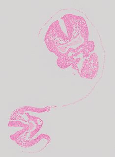 ds_10283_1180