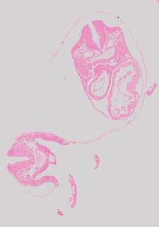ds_10283_1183
