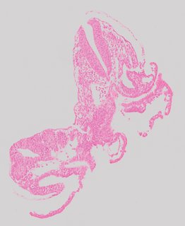 ds_10283_1193