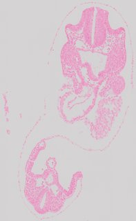 ds_10283_1216