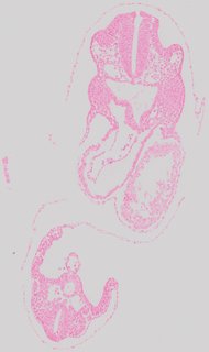 ds_10283_1217
