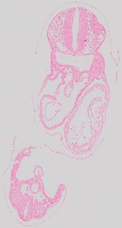 ds_10283_1218