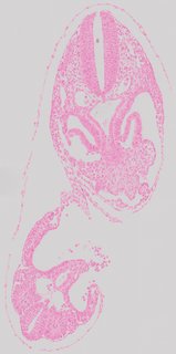 ds_10283_1226