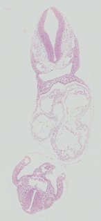ds_10283_1255