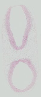 ds_10283_1276