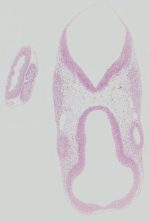 ds_10283_1279