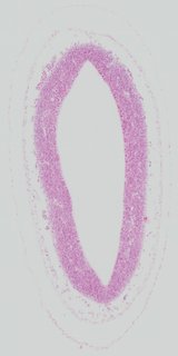 ds_10283_1379