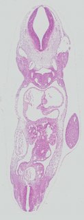 ds_10283_1417