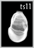 TS11