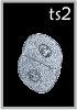TS2